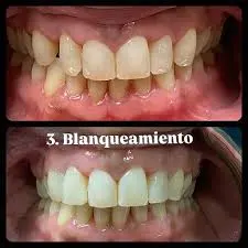 Foto de Dra. Samantha Catiari (Excellence Dental)