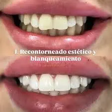 Foto de Dra. Samantha Catiari (Excellence Dental)