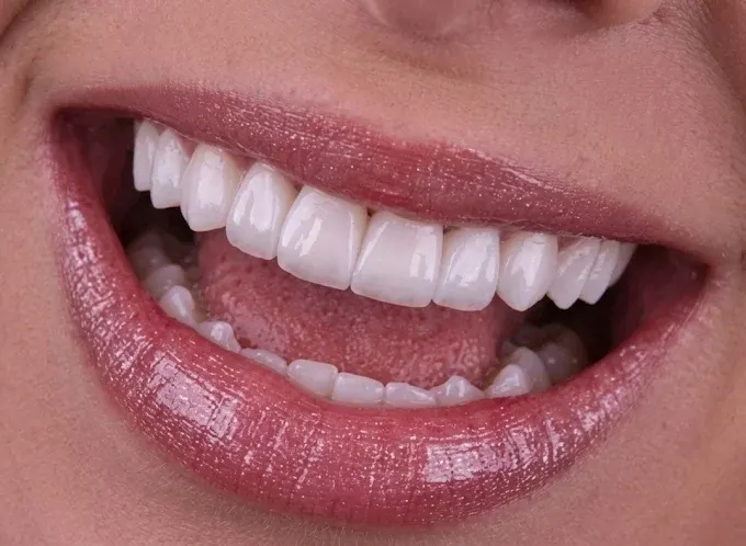 Foto de Dra. Samantha Catiari (Excellence Dental)