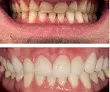 Foto de Dra. Nagila Fernandes (Clínica Dental Santé)