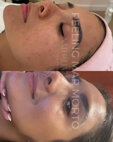 Foto de Skin Care Clinic - Nathalia Marques Spa Beauty and Aesthetics