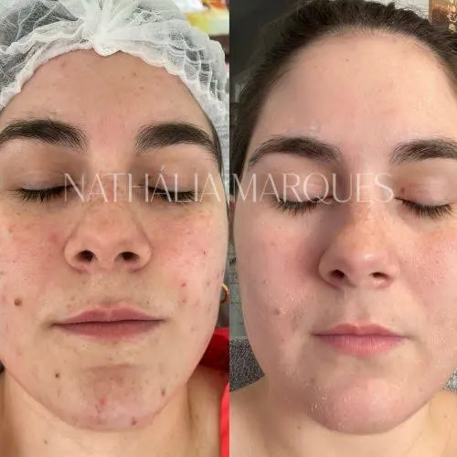 Foto de Skin Care Clinic - Nathalia Marques Spa Beauty and Aesthetics