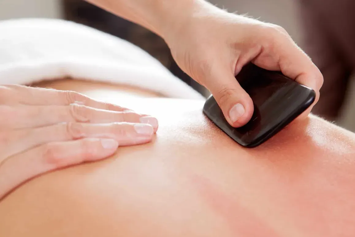 Foto de Adriano Silva | Acupuncture
