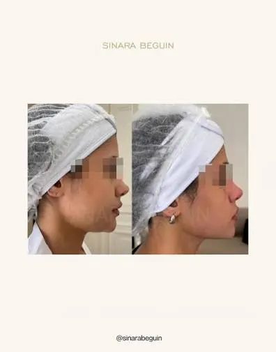 Foto de Institut Sinara Beguin